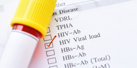 An HIV viral load test