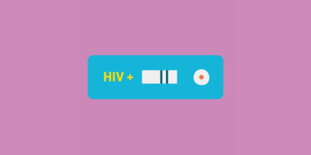 Blue HIV testing kit showing a positive result
