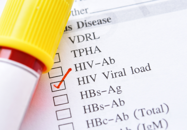 An HIV viral load test